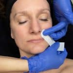 Bovenlip waxen in Purmerend