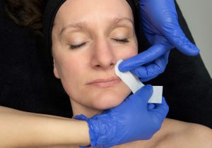 Bovenlip waxen in Purmerend