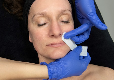 Bovenlip waxen in Purmerend