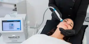 Behandeling Aquapeel ///