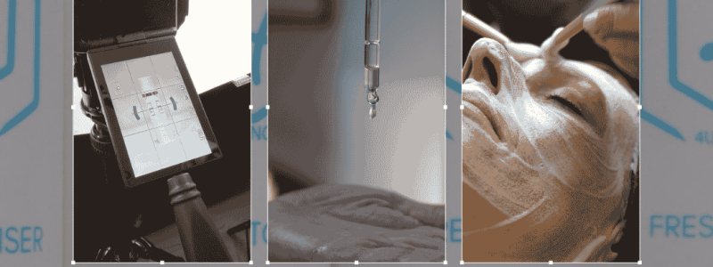 4U Skincare stappenplan